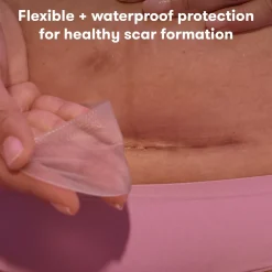 Silicone Scar Patches